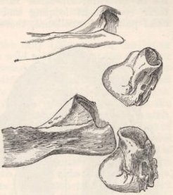 Fig. 8—Part of Zygomatic Arch.